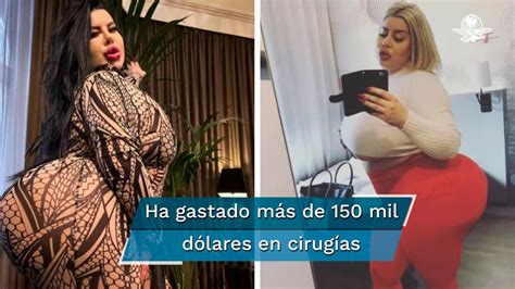 culo mas grande del mundo|Impactante: así luce la mujer que busca tener los glúteos más。